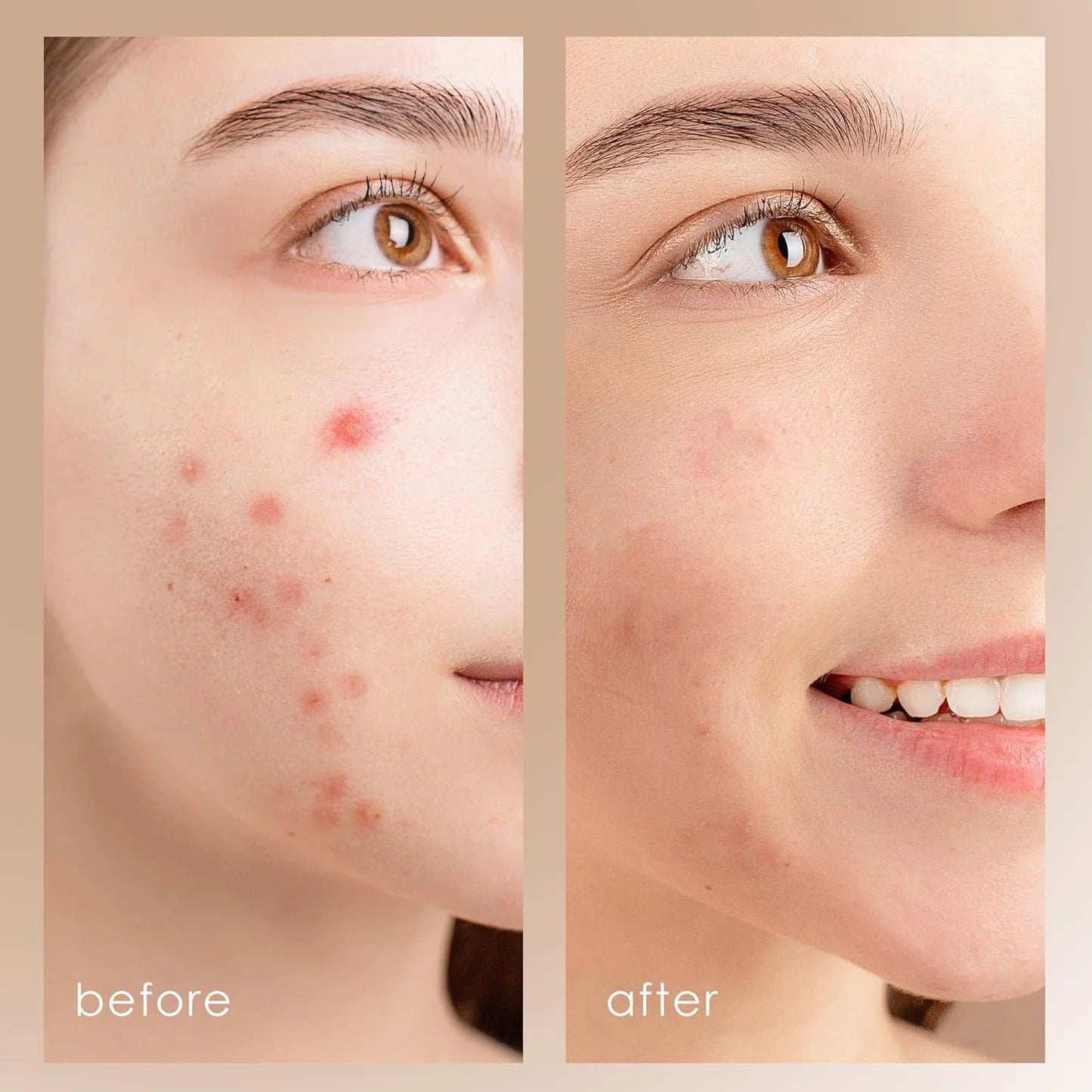 Limpiador Facial Ultrasonico
