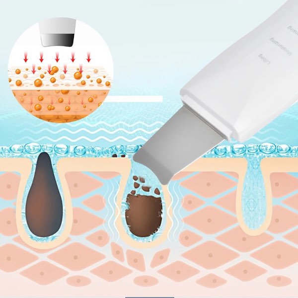 Limpiador Facial Ultrasonico